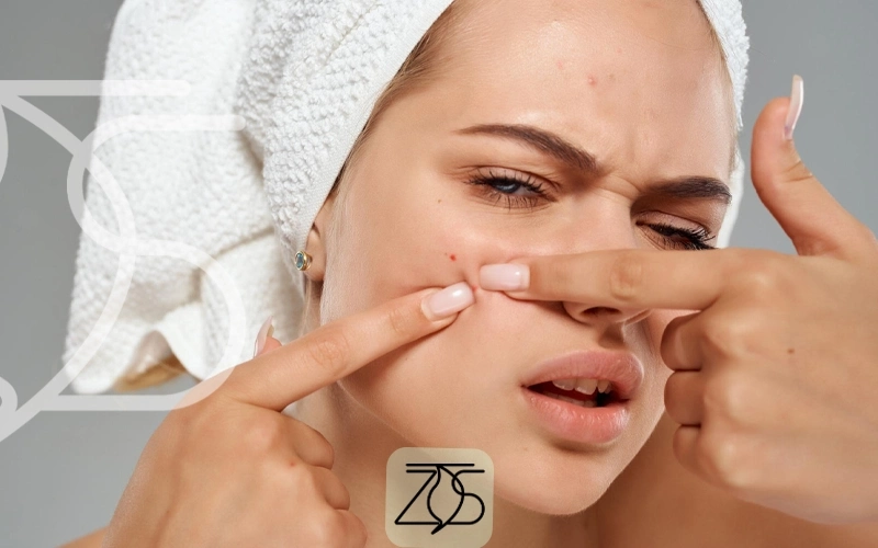 از بین بردن جوش و لکه صورت