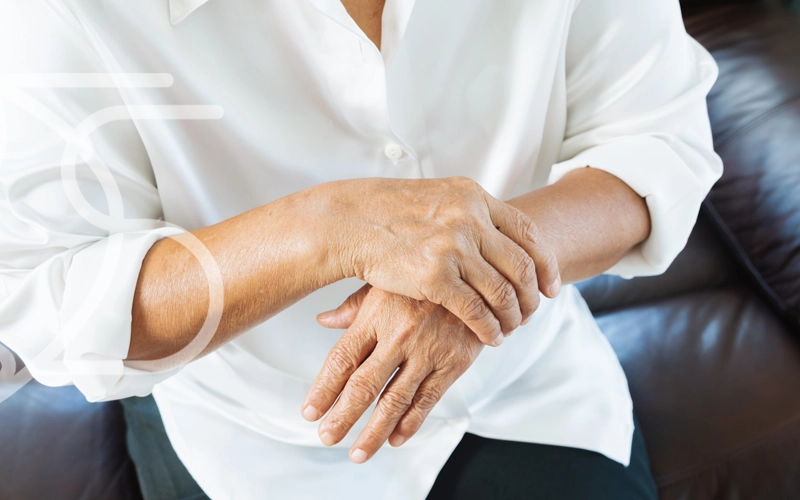 آرتروز مچ دست