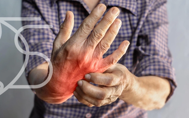 شناخت انواع آرتروز