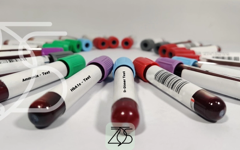 جدول خون سنین