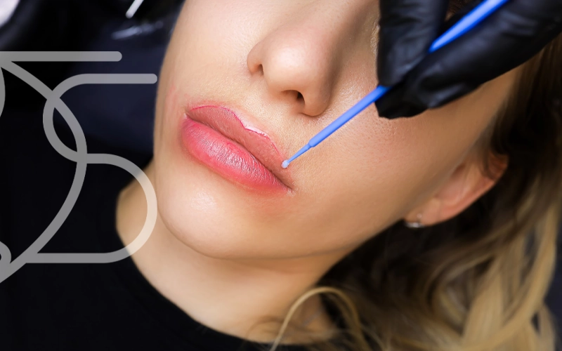 کاشت خط لب دائمی