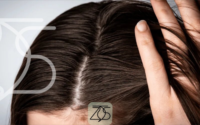 چند بار در هفته باید موهای چرب را بشوییم؟
