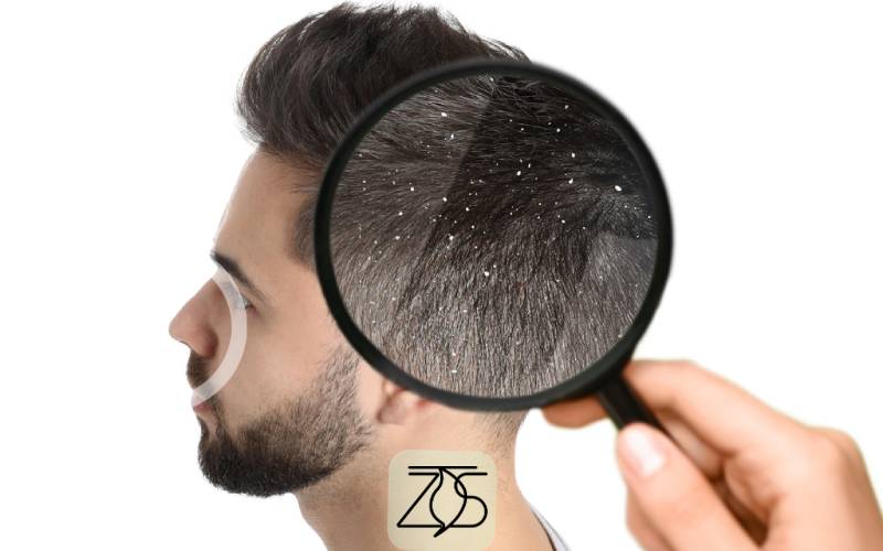 بهترین شامپو ضد شوره خارجی