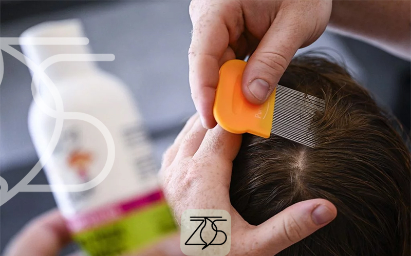 بهترین شامپو برای شپش خارجی