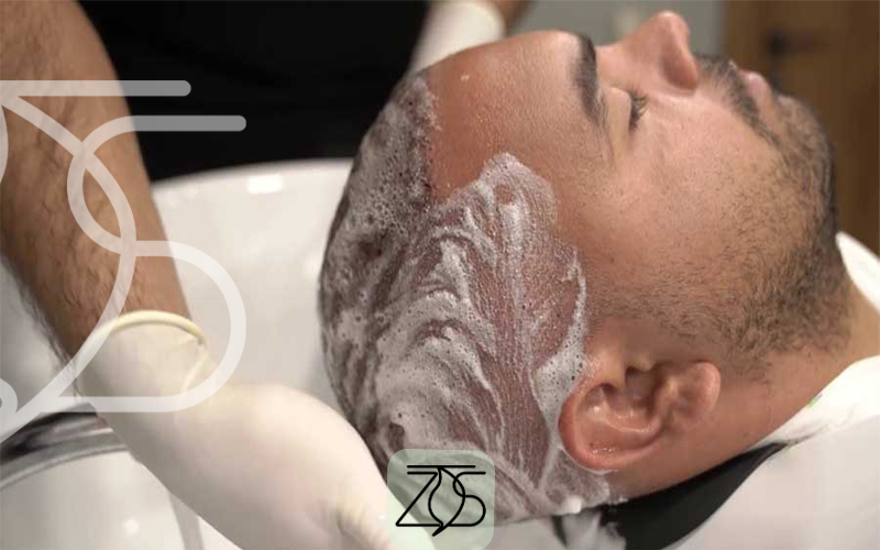 بهترین شامپوها بعد از کاشت مو